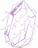 OVERCHARGE